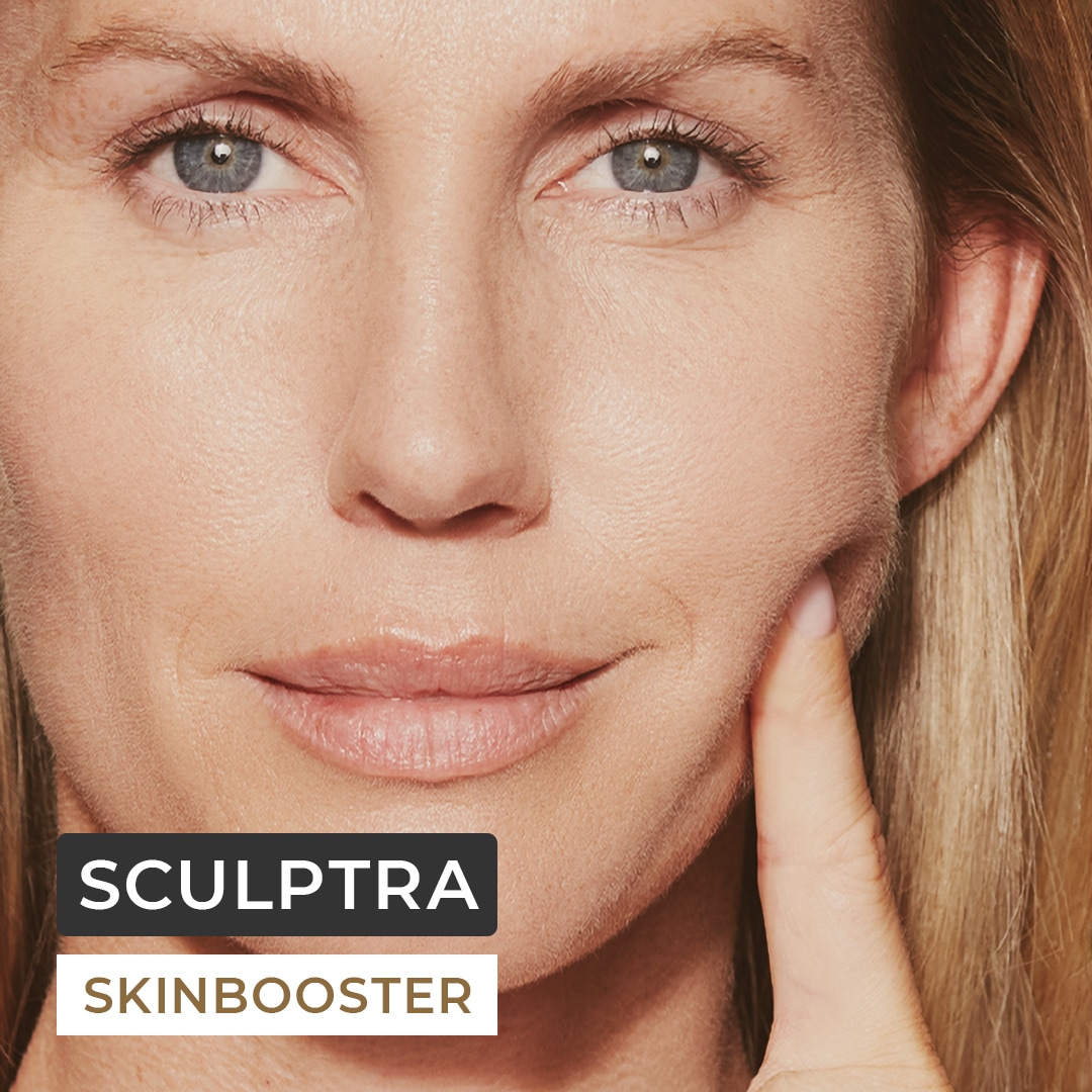 Sculptra behandeling, sculptra resculpt, sculptra amsterdam, sculptra before
