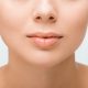 julia akkerman, ervering belkyra behandeling, review kybella