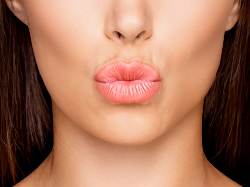 fillers, fillers amsterdam, filler behandeling, injectable lippen, resculpt, resculpt aesthetics